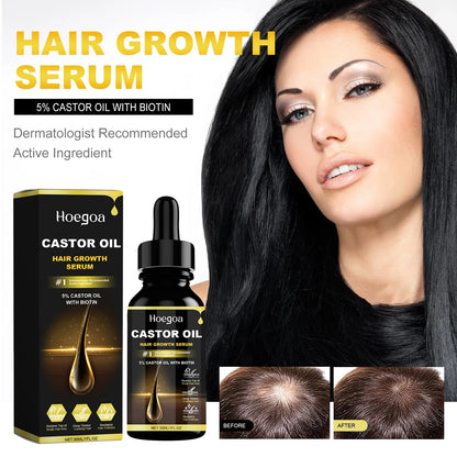 Hoegoa 30ml Castor Oil Hair Thickening Essential Oil Nourish Scalp Massage Refreshing Hair Growth Repair Smoothing Hair Care Oil