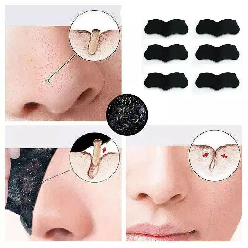 Bamboo Charcoal Blackhead Nose Strips
