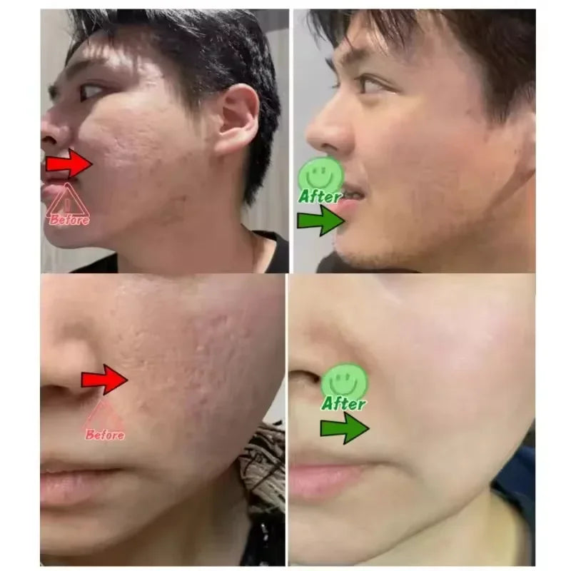 Pore Shrinking Cream Elimination Large Pores Blackehead Remove Acne Pit Repair Gel Tighten Face Smooth Skin Korean Care Products - PrimeNest
