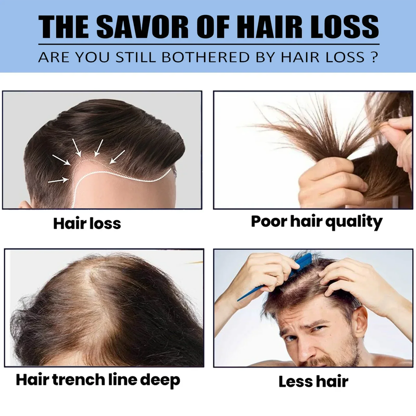 Biotin fast Hair Growth oil Products Care Scalp Massage Treatments Anti Hair Loss Effective Grow Thicker Hair serum for men
