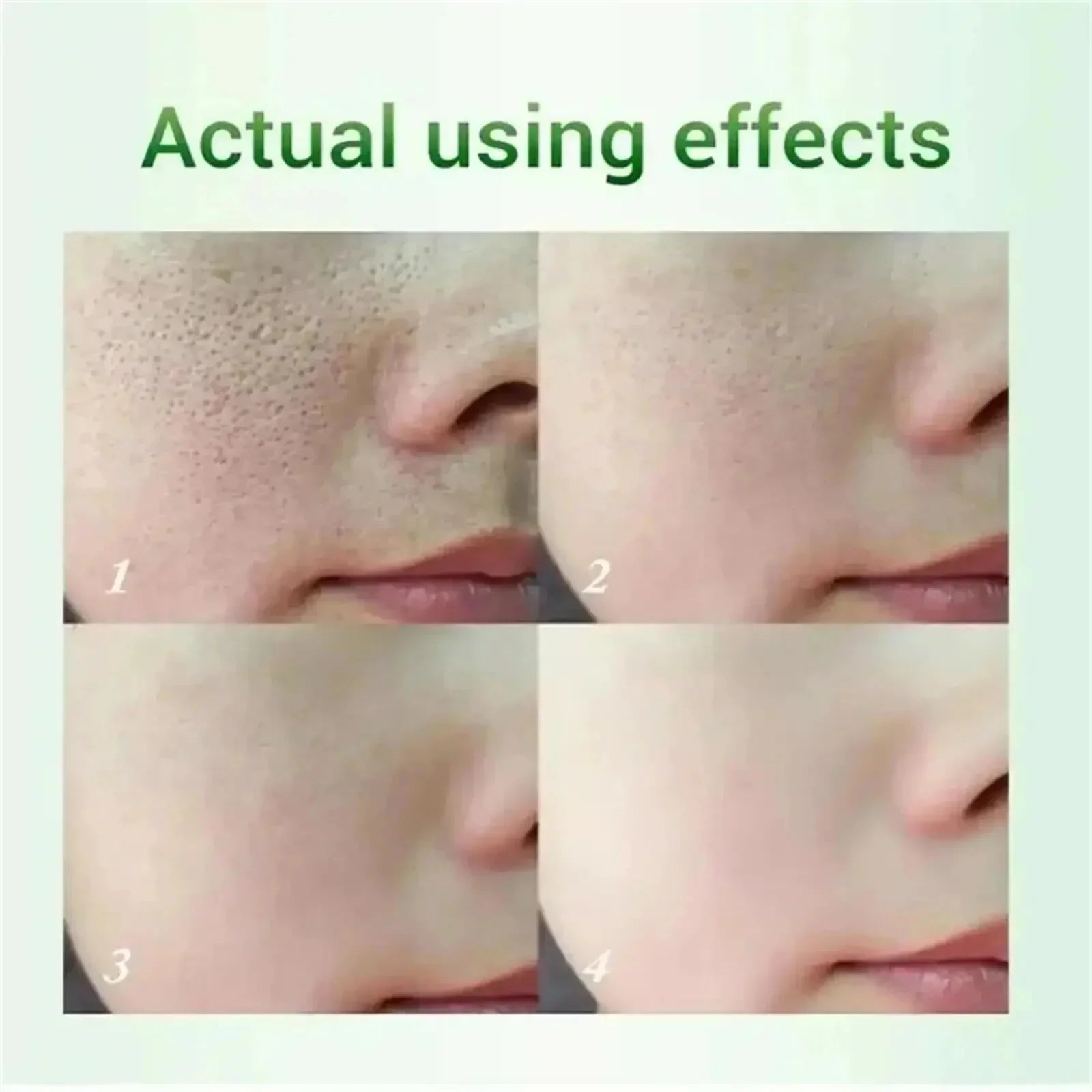 Pore Shrinking Cream Elimination Large Pores Blackehead Remove Acne Pit Repair Gel Tighten Face Smooth Skin Korean Care Products - PrimeNest