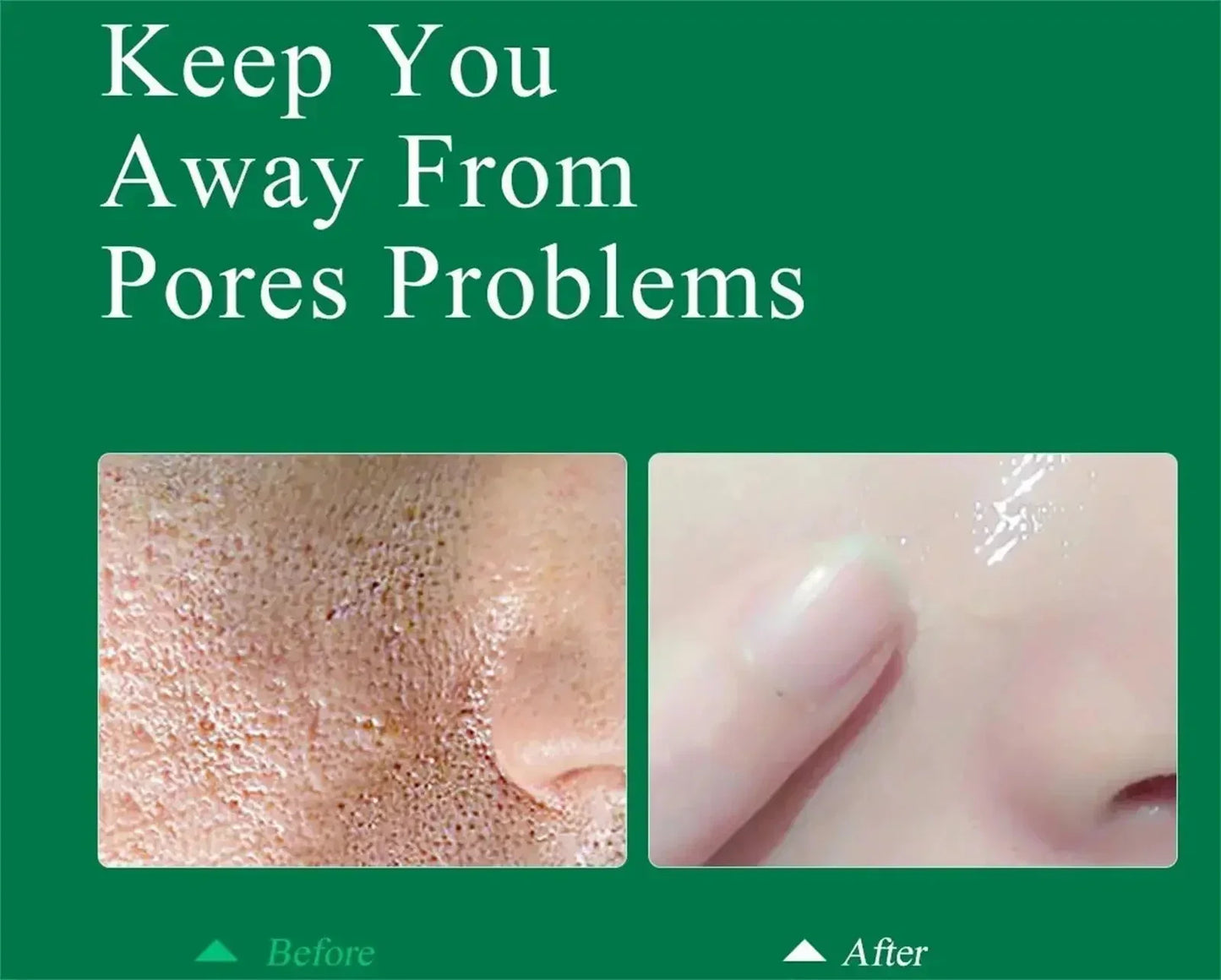 Pore Shrinking Cream Elimination Large Pores Blackehead Remove Acne Pit Repair Gel Tighten Face Smooth Skin Korean Care Products - PrimeNest