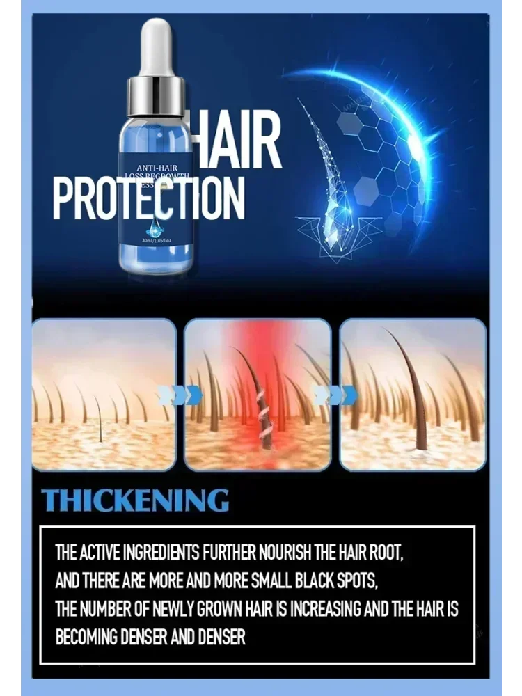 Biotin fast Hair Growth oil Products Care Scalp Massage Treatments Anti Hair Loss Effective Grow Thicker Hair serum for men