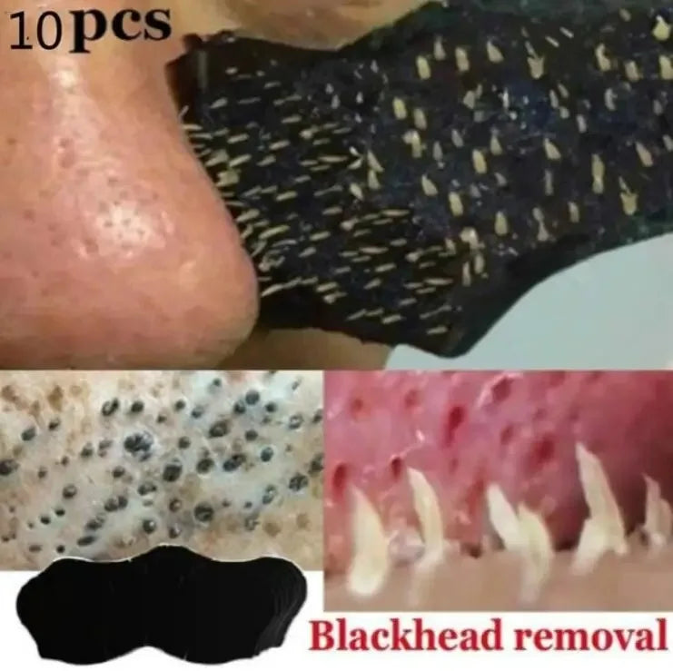 Bamboo Charcoal Blackhead Nose Strips