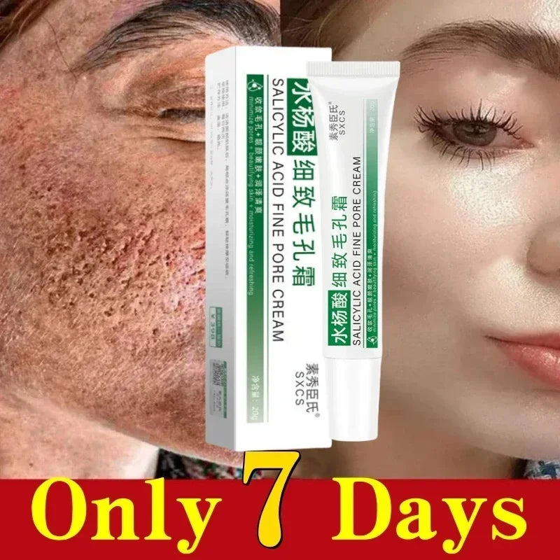 Pore Shrinking Cream Elimination Large Pores Blackehead Remove Acne Pit Repair Gel Tighten Face Smooth Skin Korean Care Products - PrimeNest