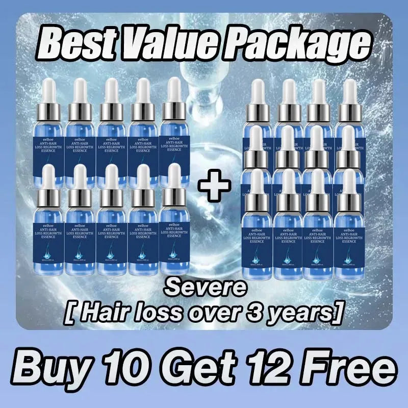 Biotin fast Hair Growth oil Products Care Scalp Massage Treatments Anti Hair Loss Effective Grow Thicker Hair serum for men