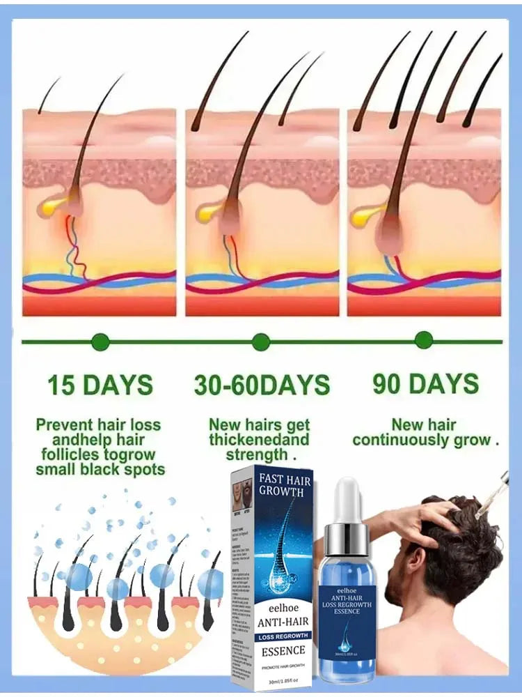 Biotin fast Hair Growth oil Products Care Scalp Massage Treatments Anti Hair Loss Effective Grow Thicker Hair serum for men