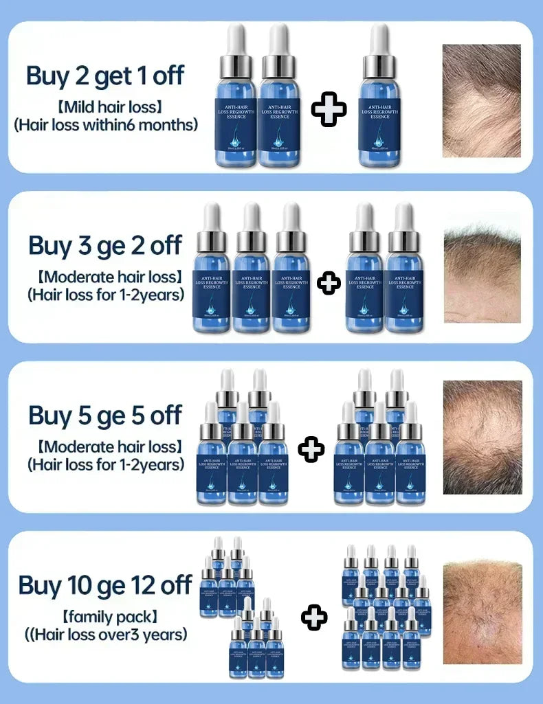 Biotin fast Hair Growth oil Products Care Scalp Massage Treatments Anti Hair Loss Effective Grow Thicker Hair serum for men