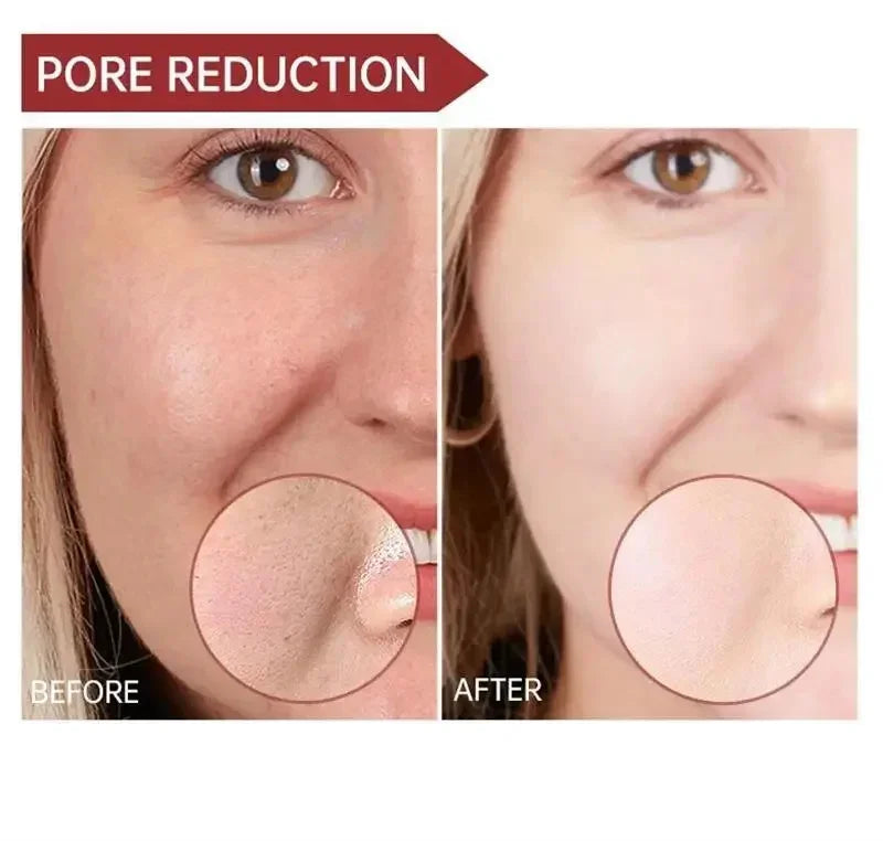 Pore Shrinking Cream Elimination Large Pores Blackehead Remove Acne Pit Repair Gel Tighten Face Smooth Skin Korean Care Products - PrimeNest