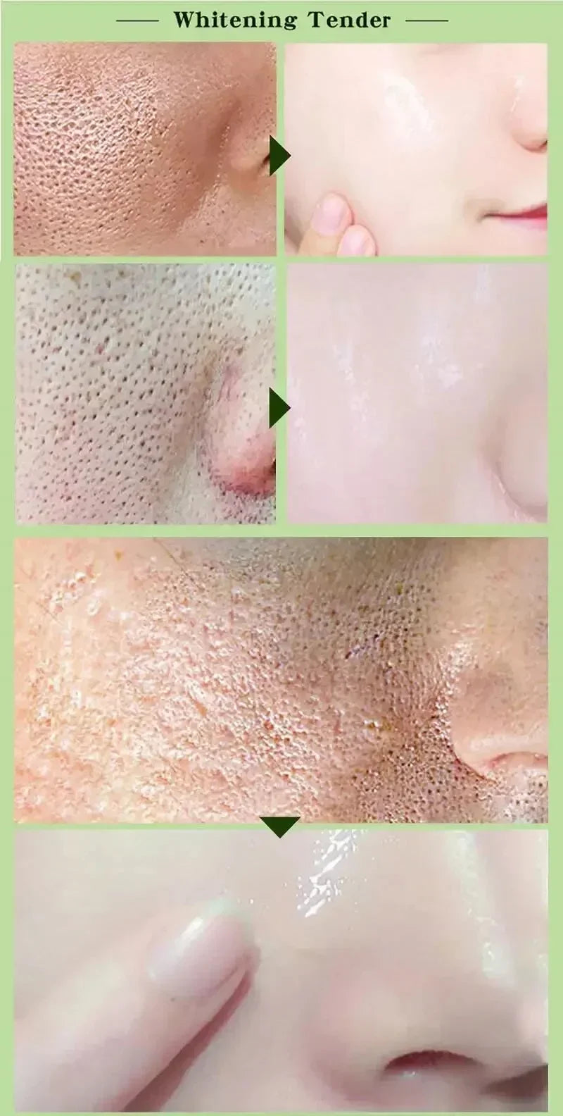 Pore Shrinking Cream Elimination Large Pores Blackehead Remove Acne Pit Repair Gel Tighten Face Smooth Skin Korean Care Products - PrimeNest