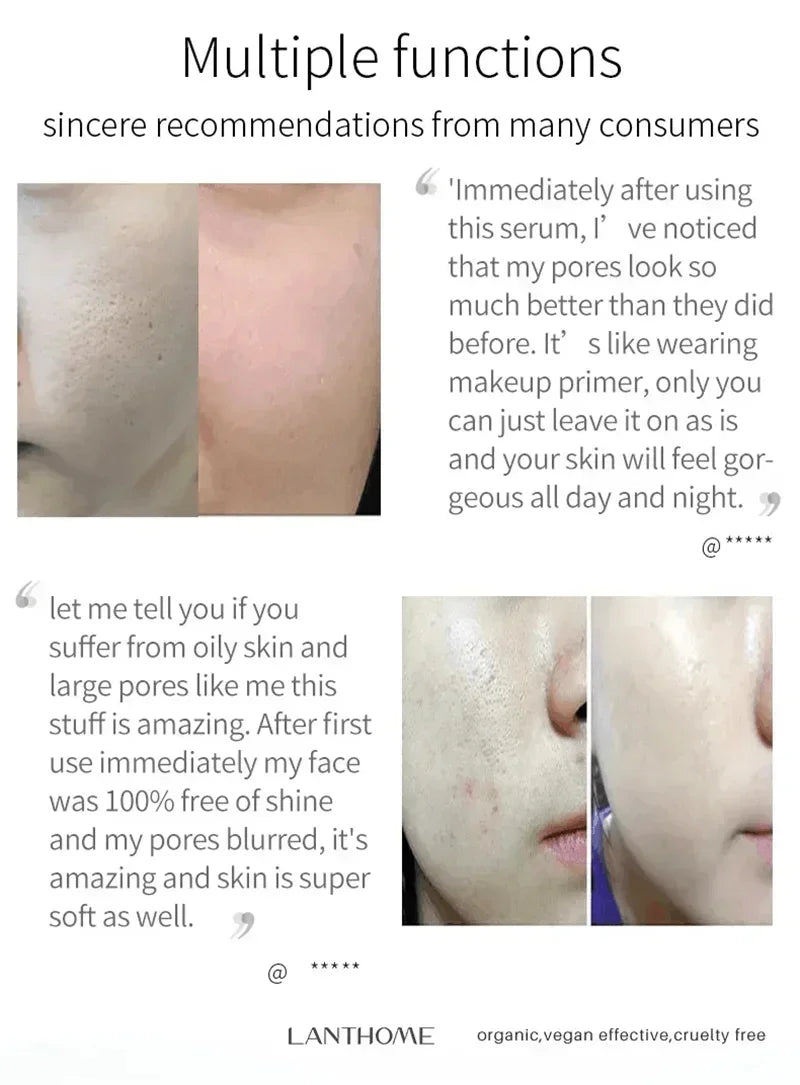 Pore Shrinking Cream Elimination Large Pores Blackehead Remove Acne Pit Repair Gel Tighten Face Smooth Skin Korean Care Products - PrimeNest