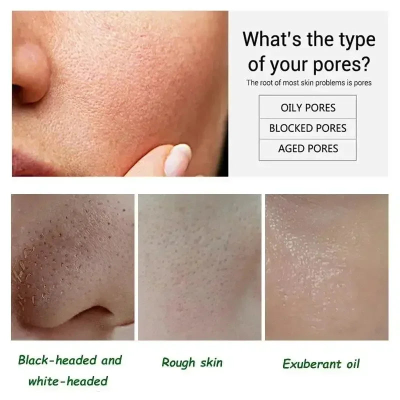 Pore Shrinking Cream Elimination Large Pores Blackehead Remove Acne Pit Repair Gel Tighten Face Smooth Skin Korean Care Products - PrimeNest
