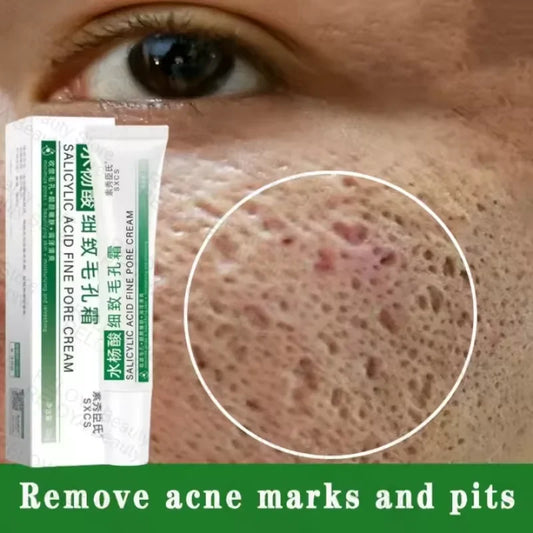 Salicylic acid pore shrinking cream tube and box with green label
