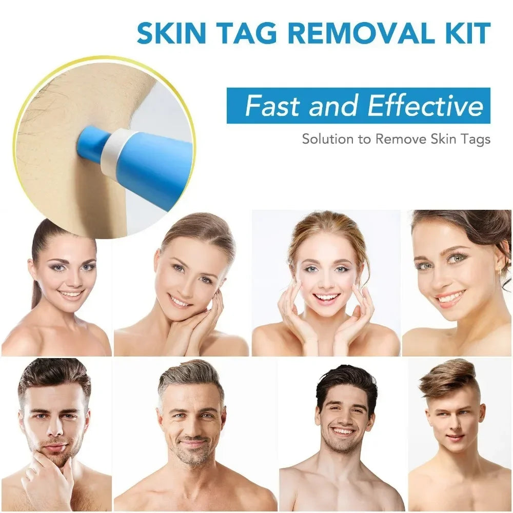 Painless Skin Tag Removal Kit