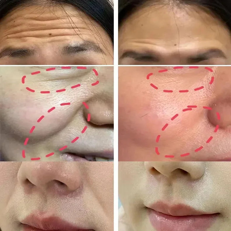Instant Wrinkle Removal Multi Bounce Balm Facial Tightening Moisturizing Korean Anti-Wrinkle Balm Stick Cream Skin Care Products - PrimeNest