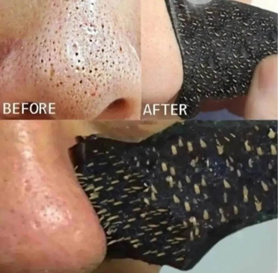 Bamboo Charcoal Blackhead Nose Strips
